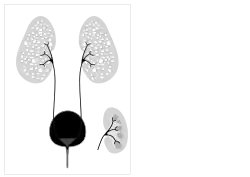Autosomal recessive polycystic kidney disease
