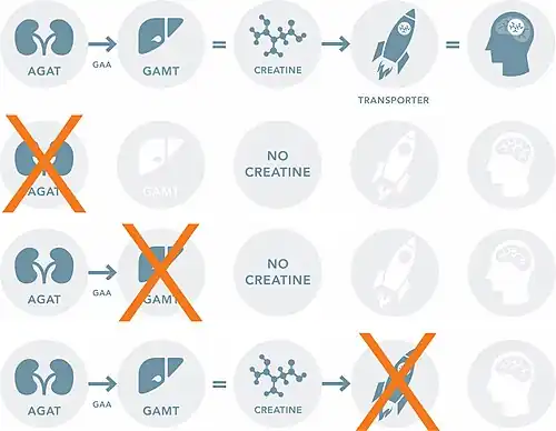 Depiction of normal creatine production pathway (top), creatine production in AGAT deficiency, creatine production in GAMT deficiency, creatine production in creatine transporter deficiency (bottom)