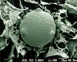 Scanning electron image of a sporangium of Batrachochytrium dendrobatidis. The sproangium is spherical with four discharge papillae spaced equidistant around the circumference of the sphere.