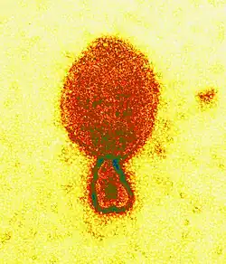 Colored transmission electron micrograph of a Hendra virus virion (ca. 300 nm length)