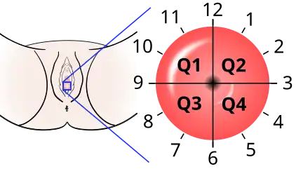 The location of cervical cancer can be described in terms of quadrants, or corresponding to a clock face when the subject is in supine position.
