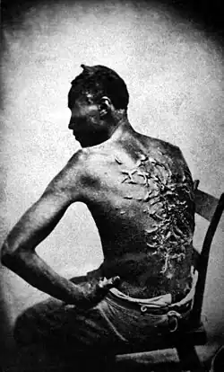 Image 14 Slavery in the United States Photo credit: McPherson and Oliver Scars of a whipped slave named Peter, photo taken at Baton Rouge, Louisiana, 1863. In his own words, "Overseer Artayou Carrier whipped me. I was two months in bed sore from the whipping. My master come after I was whipped; he discharged the overseer." The slave pictured here escaped from a plantation in Mississippi, made his way to Union forces, and joined the U.S. Army at the Union garrison located at Baton Rouge. Slavery in the United States began soon after the English colonists first settled in North America. From about the 1640s until 1865, people of African descent were legally enslaved within the boundaries of the present U.S. mostly by whites, but also by a comparatively tiny number of American Indians and free blacks. By 1860, the slave population in the U.S. had grown to 4 million. More selected pictures