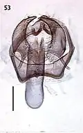 Male genitalia