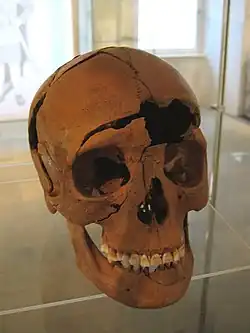 Skull of a 20- to 30-year-old decapitated woman of the 3rd century AD. Cutting marks above the right eye socket show the head has been scalped.