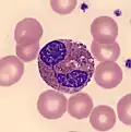 Eosinophil