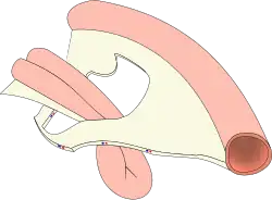 Diagram of a hernia: a loop of bowel protruding through a hole in tissue