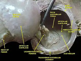 Hip joint. Lateral view.