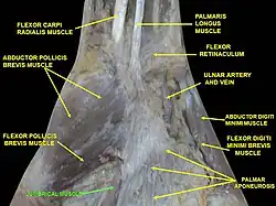 Lumbricals muscle