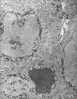 Electron micrograph of Saint Louis encephalitis virus seen in a mosquito salivary gland