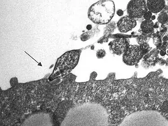 Mycoplasma pneumoniae