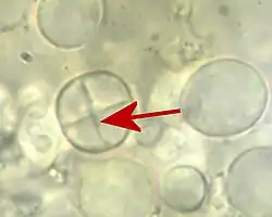 Phragmobasidie met septum in de lengterichting, bovenaanzicht