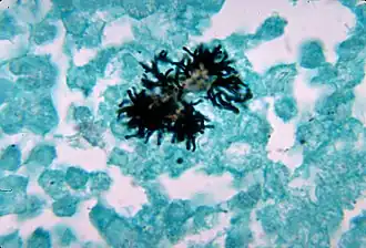 Actinomyces naeslundii