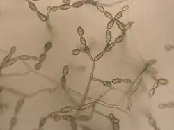 Vertakte conidiofoor