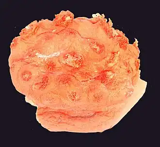 Anthomastus grandiflorus