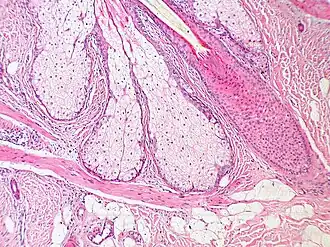 Musculus arrector pili