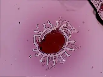 Bosmina (Eubosmina) coregoni