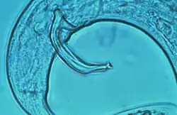 Mannetje met spiculum