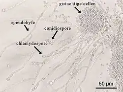 Chlamydospore van de gist Candida albicans