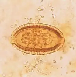 Ei van Capillaria philippinensis