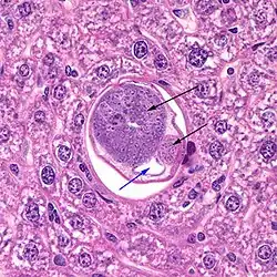 darm (blauwe pijl) en gespiraliseerde delen van de testikel (zwarte pijlen)