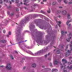 darm (blauwe pijl) en bacillaire banden (zwarte pijlen)