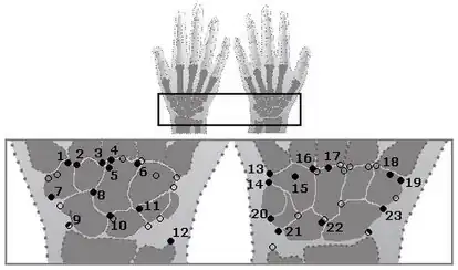 De lokalisaties van de accessoire handwortelbeentjes. Links de rechterhand van dorsaal, rechts vanaf palmair.