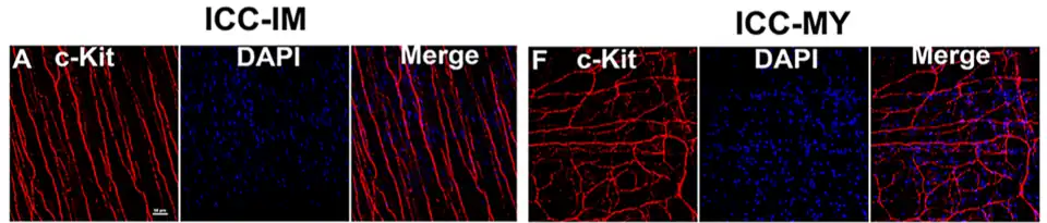 Karakteristieke rangschikking van de cellen van Cajal in de intramusculaire (links) en myenterische (ICC-MY) plexus (rechts). Membraanreceptorproteïne KIT. confocale microscoop.