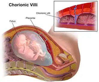 Chorionvilli