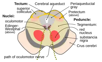 Snede door de colliculus superior met het verloop van de nervus oculomotorius.