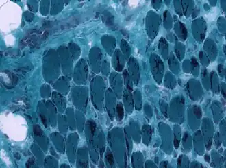 Nemalinestaafjes zichtbaar in spiercellen