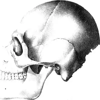 Schedel gevonden in Grave Greek Mound, Crania Americana, or, A comparative view of the skulls of various aboriginal nations of North and South America - to which is prefixed an essay on the varieties of the human species (1839), From the Grave-Creek Mound near Wheeling, Virginia, Samuel George Morton (1799-1851)