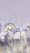 Cheilocystidia