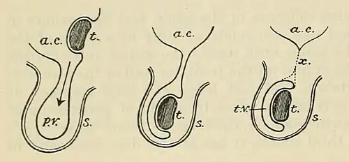 Indaling teelbal. a.c. Buikholte. p.v. Processus vaginalis. t. Teelbal. s. Scrotum. t.v. Tunica vaginalis. x. Embryonaal overblijfsel processus vaginalis.