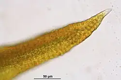 Bladcellen (bladtop)