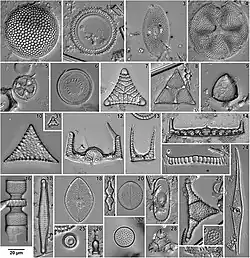 Verschillende vormen microfossielen van frustules uit het Eoceen (Blake Nose, Westelijke Noord-Atlantische Oceaan) met lichtmicroscoop.