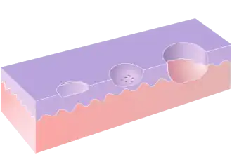 Progressieve erosie van de huid is kenmerkend voor zweren