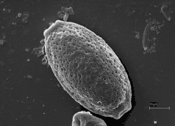 Ei van Capillaria boehmi