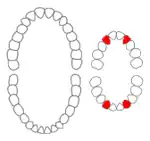 Laterale melksnijtand