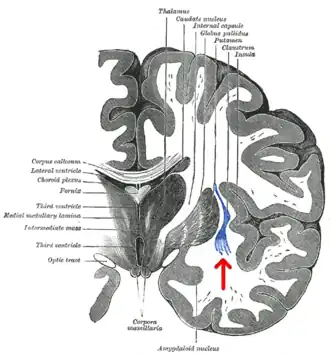 Coronale doorsnede van het menselijk brein. Het claustrum wordt aangegeven met een pijl.