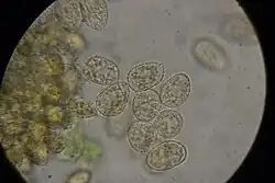 Urediniasporen van de wilgenroosjeroest