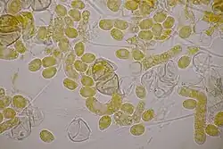 Urediniosporen in telia op jeneverbes