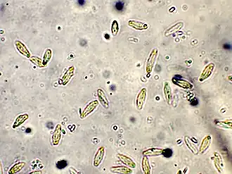 Spermatiën van lijsterbes-jeneverbesroest op wilde lijsterbes
