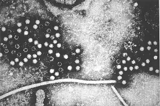Hepatitis E-virus