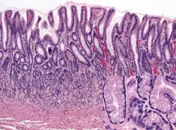 Het maagslijmvlies (antrale mucosa), H&E-gekleurd. Bovenaan de coupe zijn geplooide, secretoire cellen zichtbaar.