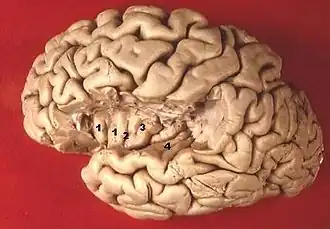 alt=Linkergrotehersenhelft. Deel dat dat gewoonlijk het eiland van Reil bedekt, is verwijderd. 1. Gyri breves insulae, 2. Sulcus centralis insulae, 3. Gyrus longus insulae, 4. Gyri temporales transversi.