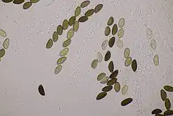 Sporenzakjes met ascosporen