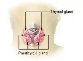 Hyperparathyreoïdie