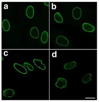 Normale kernlamina (a en b) en mutant-kernlamina (c en d) van een patiënt met progeria, zichtbaar gemaakt door immunofluorescentie. Merk op hoe laminopathische celkernen onregelmatig van vorm zijn.[1]
