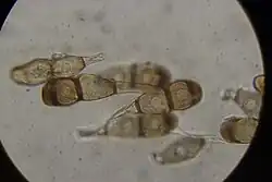 Teliosporen op moeraswalstro