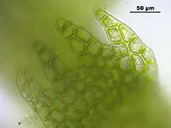 Bladcellen van onderbladeren